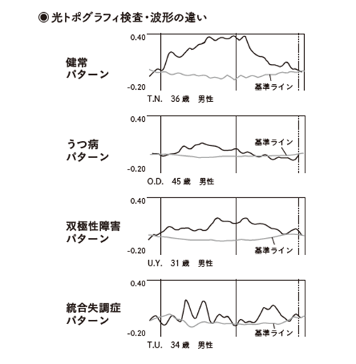 ひょっとして双極性 型障害かも うつの再発を繰り返す人は 疑ってみることが大事です 3ページ目 Human Capital Online ヒューマンキャピタル オンライン