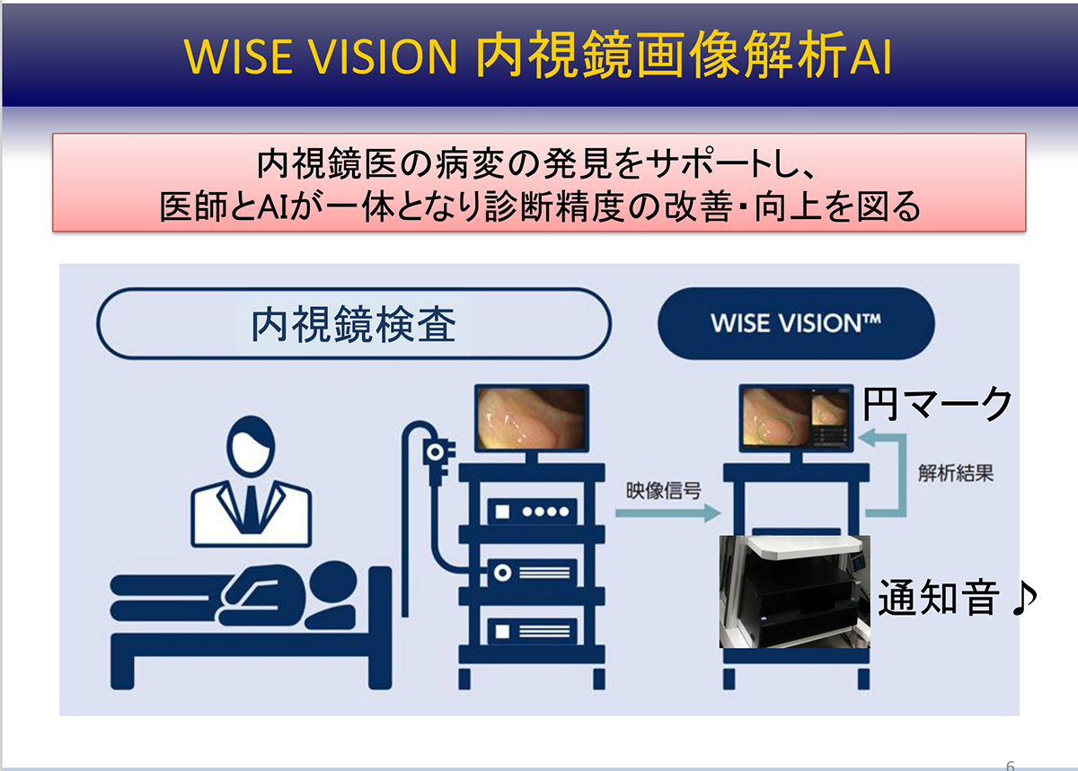 AI内視鏡”の医療機器承認を取得、国がんとNEC｜Beyond Health