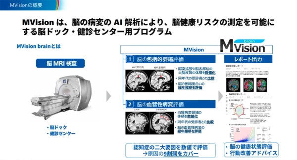 MVision brainの概要（出所：エム）