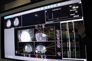 手術室内の各機器の情報は一画面上に統合され、情報空間を可視化することで術者を支援する（写真：Beyond Health）
