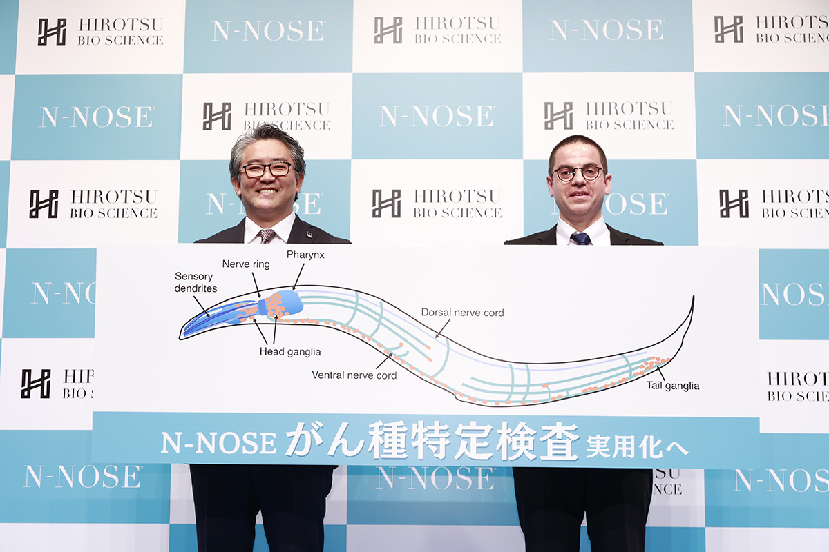 尿で「すい臓がん」特定検査、2022年中の実用化へ｜Beyond