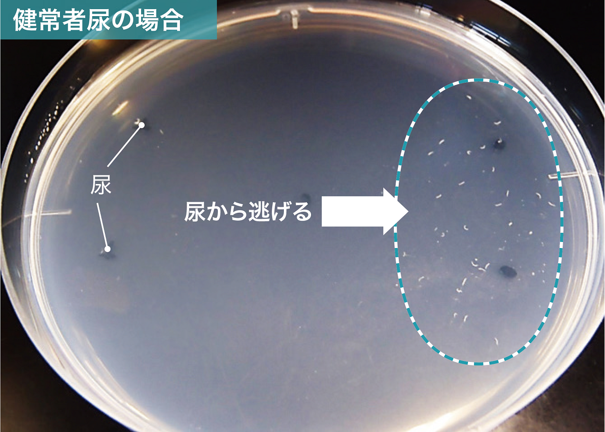 線虫がん検査」実用化は予定通りに、次はすい臓がん向け“特殊線虫”も