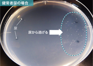 線虫がん検査」実用化は予定通りに、次はすい臓がん向け“特殊線 線虫がん検査」実用化は予定通りに、次はすい臓がん向け“特殊線