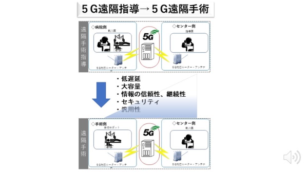 5Gを利用した「遠隔指導」と「遠隔手術」のイメージ