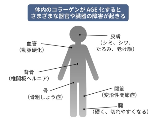 図表1●コラーゲンのAGE化が人体に及ぼす影響(出所:『老けない人は何が違うのか』(合同出版)を基にBeyond Health作成)