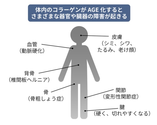 図表1●コラーゲンのAGE化が人体に及ぼす影響（出所：『老けない人は何が違うのか』（合同出版）を基にBeyond Health作成）