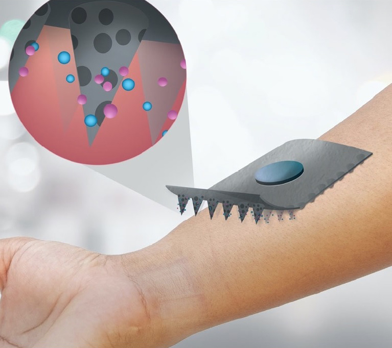 皮膚に貼るだけで血糖値測定、東大生産研がマイクロニードルパッチ型