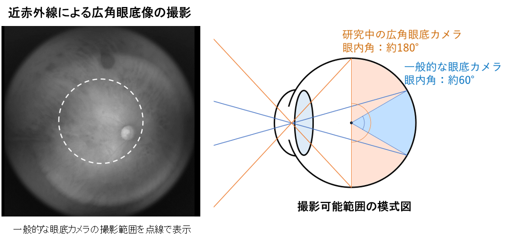 視野角180度の眼底カメラを共同開発、タムロンと奈良先端大｜Beyond