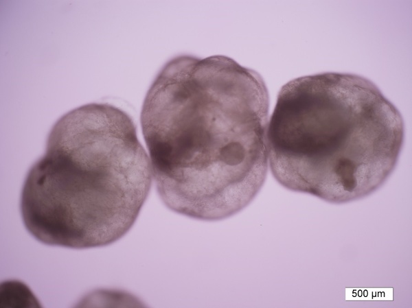 ミニ腸(出所:プレスリリース、以下同)