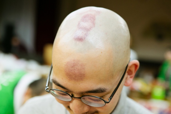 Vol 4 ハゲが観光資源に 青森県鶴田町の 春の有多毛 うたげ に行ってみた 2ページ目 ひとまち結び Vol 4 ハゲが観光資源に 青森県鶴田町の 春の有多毛 うたげ に行ってみた 2ページ目 ひとまち結び