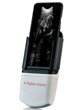 スマートフォンと連携し自宅での超音波検診を可能にしたPulseNmore(写真提供:PulseNmore)