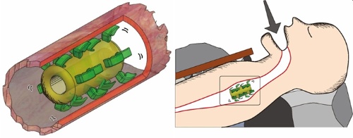 （図1）体内移動型ロボットのイメージ。口の中に挿入されると緑色の足の部分が、食道の壁を蹴りながら奥へと進んでいく。（資料提供：東北大学）