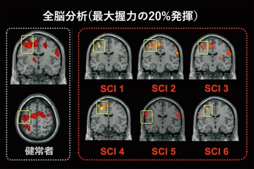 図13　力調節課題を実施している際の健常者と脊髄完全損傷者（SCI）の脳分析