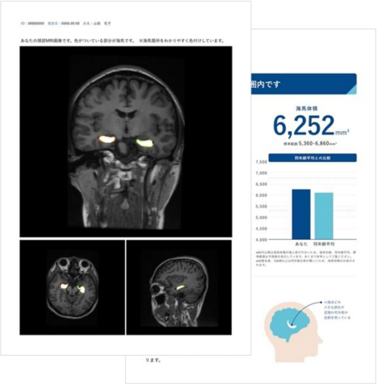 Brain Life Imagingのイメージ（出所：Splink）